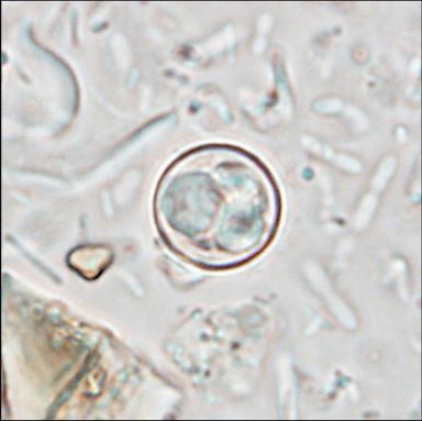 The parasite causes watery diarrhoea